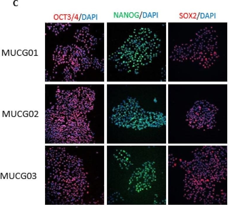 Detection of Human SOX2 by Immunocytochemistry/ Immunofluorescence