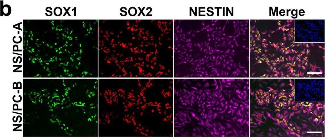 Detection of Human SOX2 by Immunocytochemistry/ Immunofluorescence