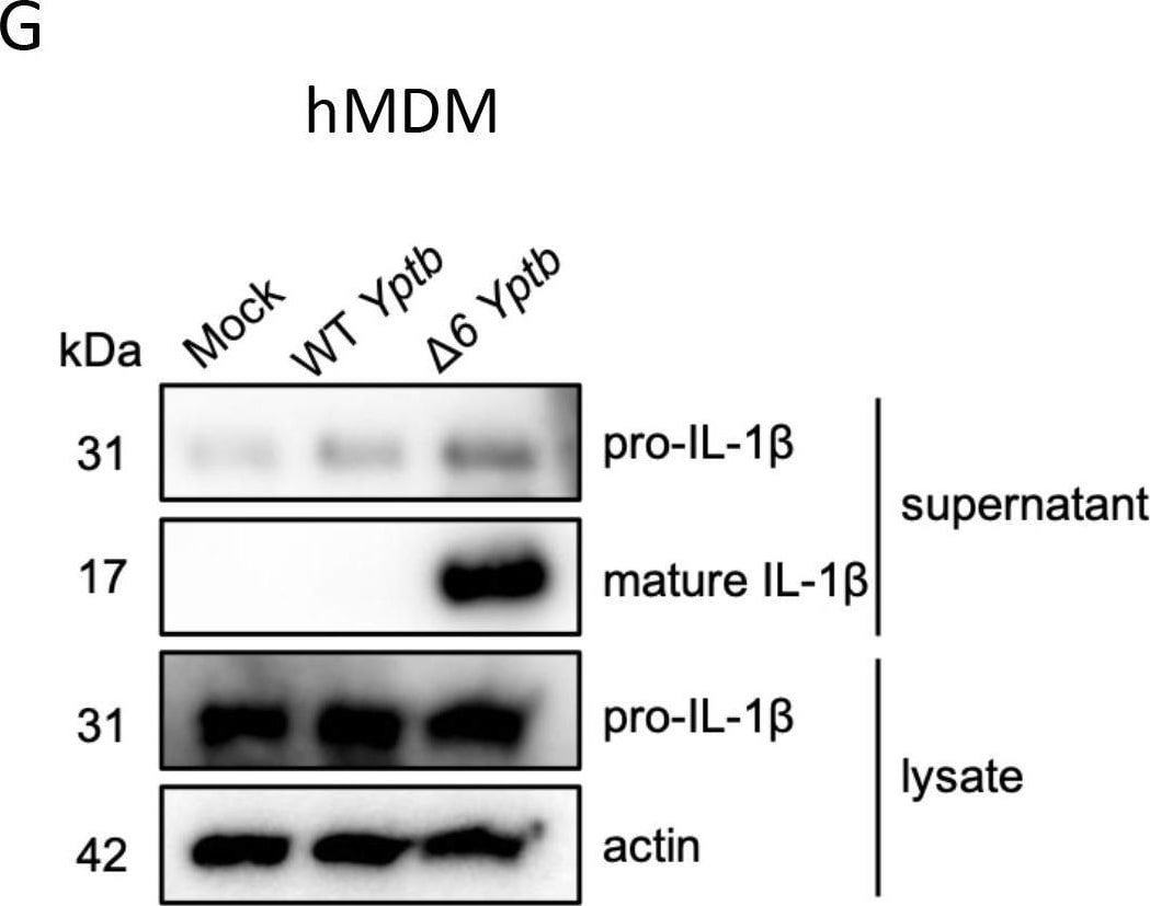 Detection of IL-1 beta /IL-1F2 by Western Blot