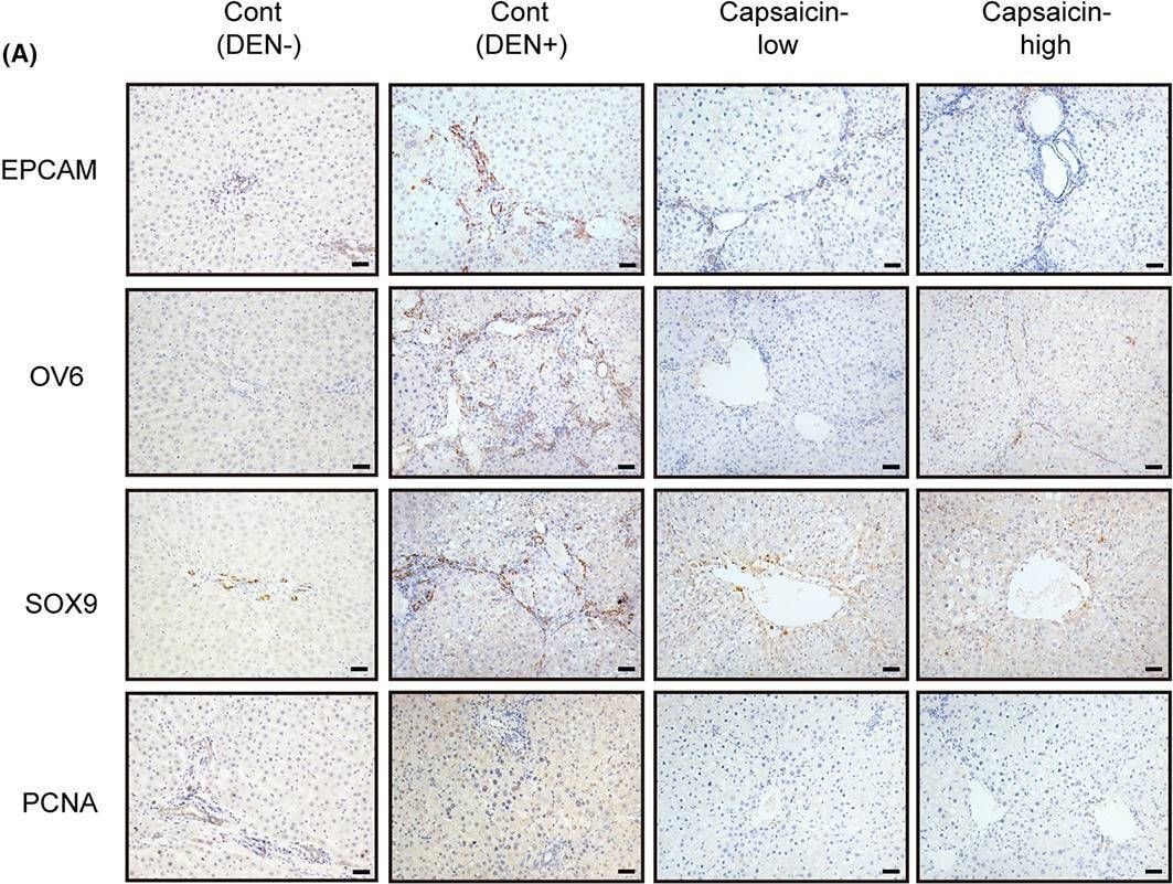 Detection of OV-6 by Immunohistochemistry