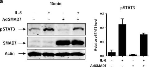 Detection of Human Smad7 by Western Blot