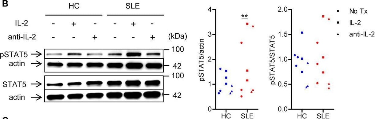 Detection of Human IL-2 by Western Blot