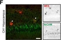 Detection of NrCAM by Immunohistochemistry