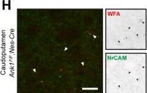 Detection of NrCAM by Immunohistochemistry