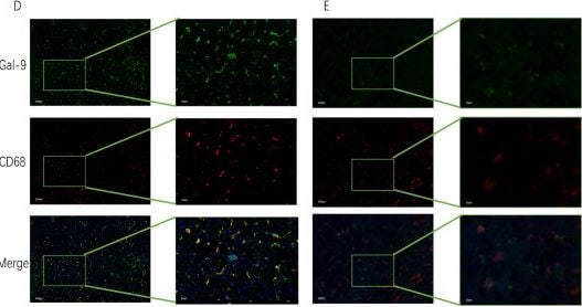 Detection of CD68/SR-D1 by Immunocytochemistry/ Immunofluorescence