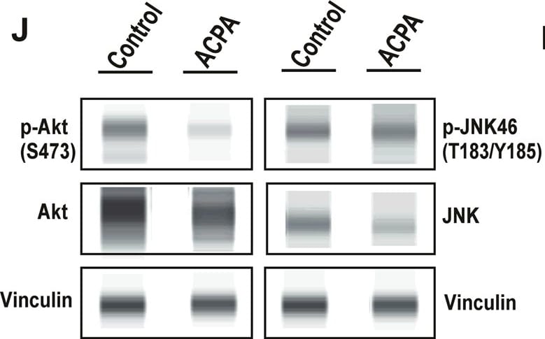 Detection of Human AKT by Simple Western