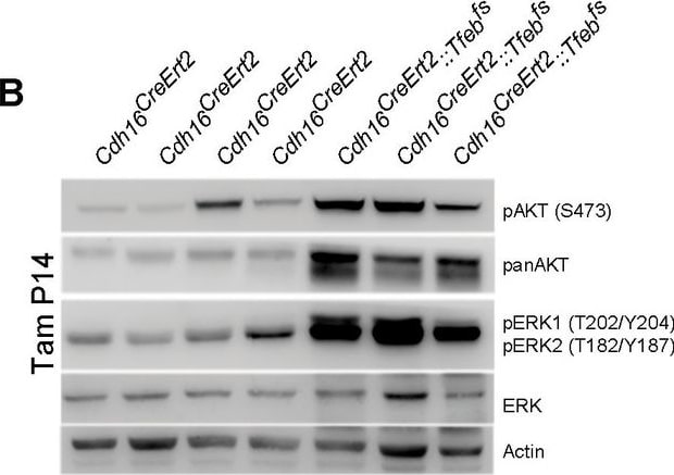 Detection of Mouse AKT by Western Blot