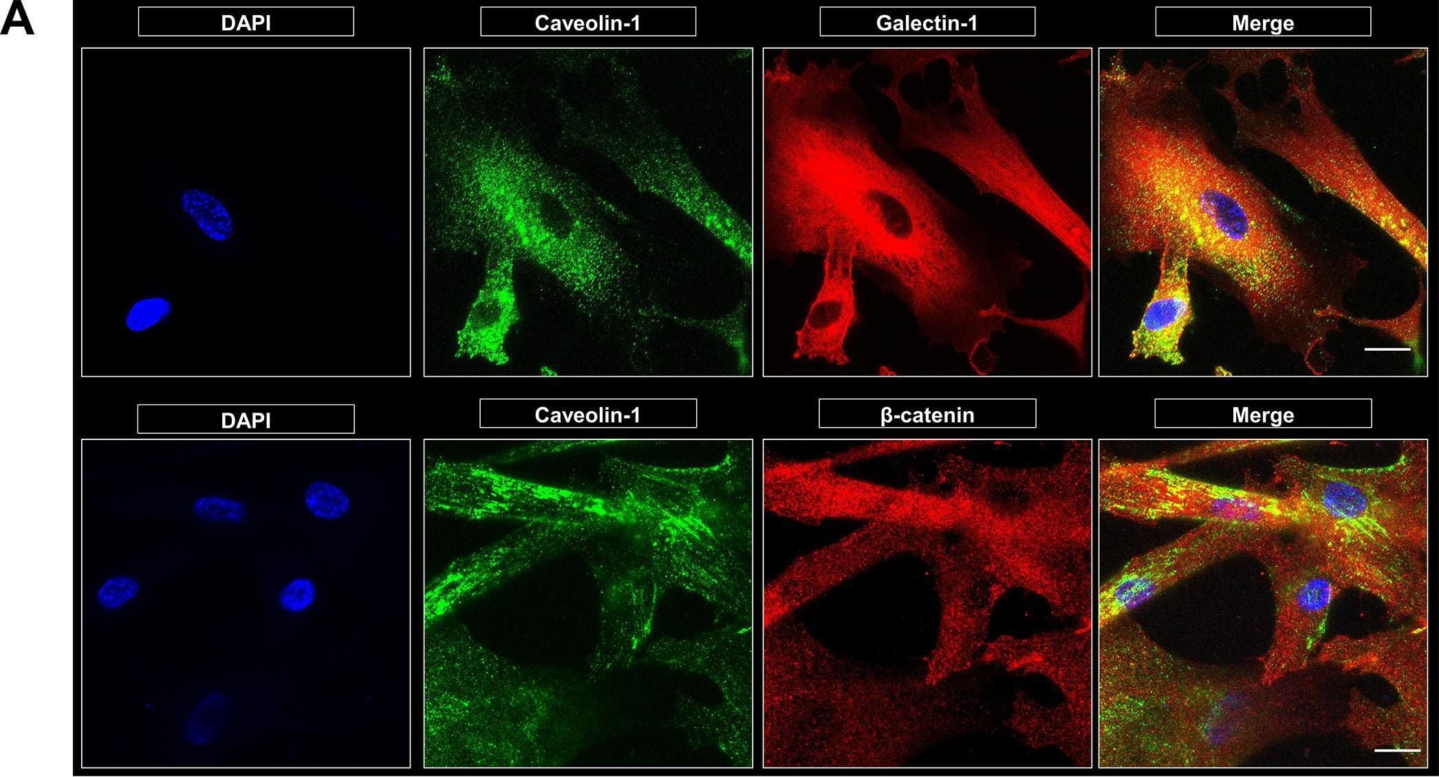 Detection of IL-8/CXCL8 by Immunocytochemistry/ Immunofluorescence