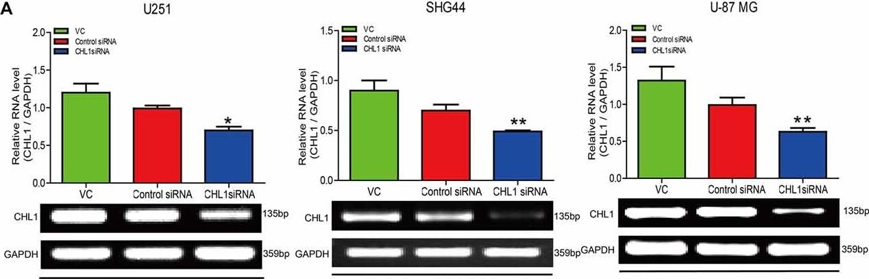 Detection of Human CHL-1/L1CAM-2 by Western Blot