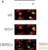 Detection of fkisk0jukvze4fxockxs.jpg by Immunocytochemistry/ Immunofluorescence