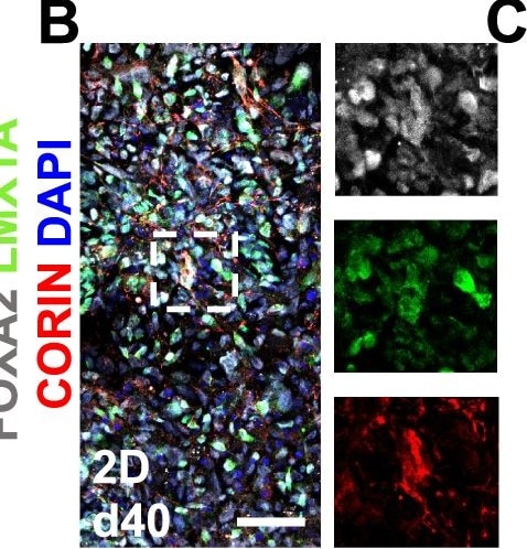 Detection of Corin Ectodomain by Immunohistochemistry