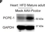 Detection of PCPE-1 by Western Blot
