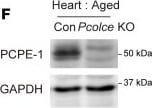 Detection of PCPE-1 by Western Blot