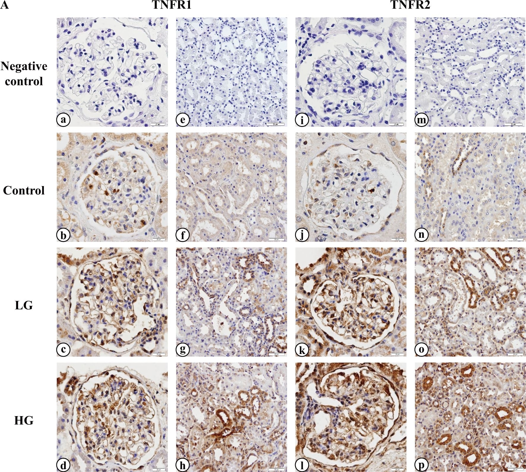 Detection of Human TNF RI/TNFRSF1A by Immunohistochemistry