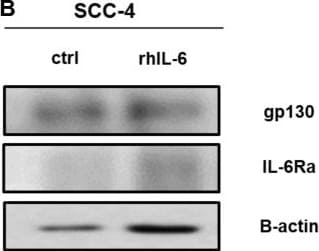 Detection of IL-6R alpha by Western Blot