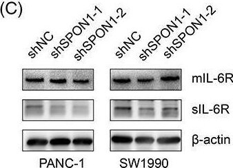 Detection of IL-6R alpha by Western Blot