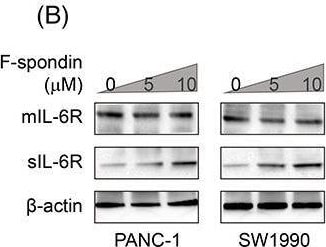 Detection of IL-6R alpha by Western Blot