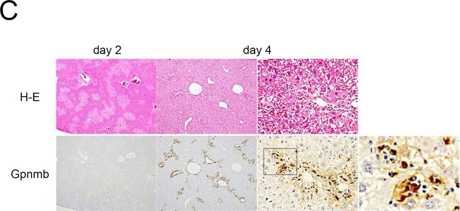 Detection of Osteoactivin/GPNMB by Immunohistochemistry