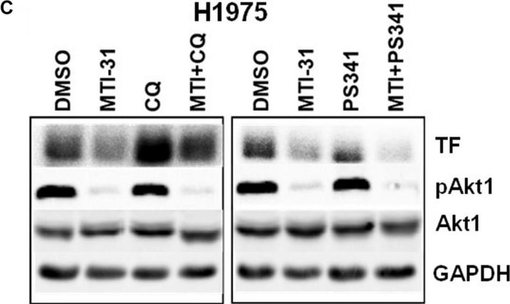 Detection of Coagulation Factor III/Tissue Factor by Western Blot