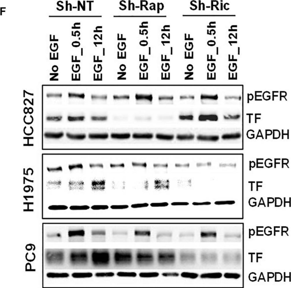 Detection of Coagulation Factor III/Tissue Factor by Western Blot