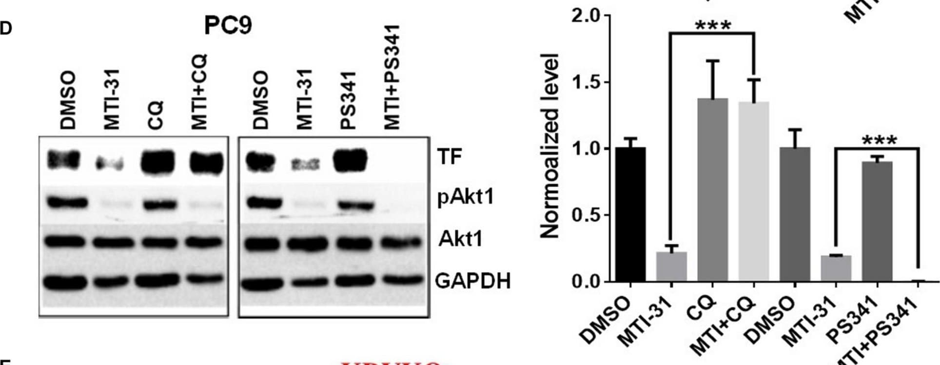 Detection of Coagulation Factor III/Tissue Factor by Western Blot