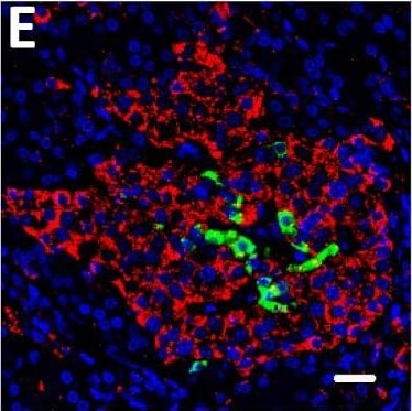 Detection of Human DPP6 by Immunohistochemistry