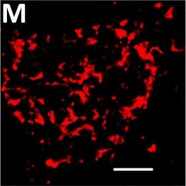 Detection of Human DPP6 by Immunohistochemistry