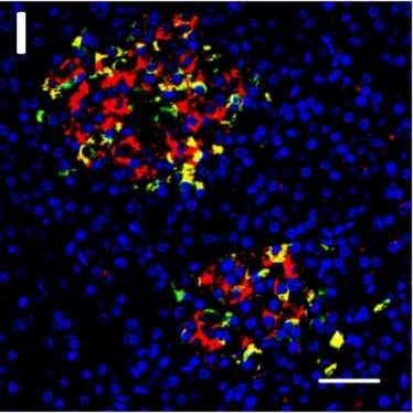 Detection of Human DPP6 by Immunohistochemistry