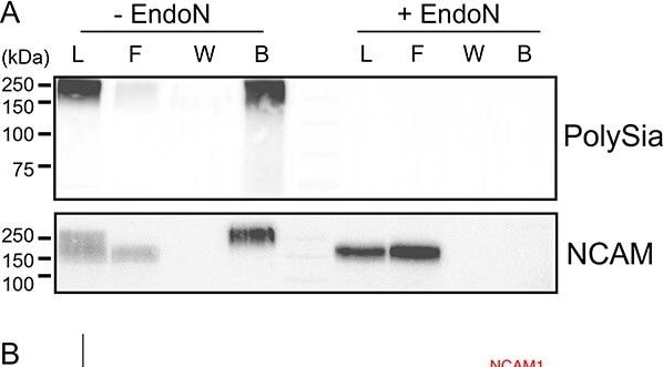 Detection of NCAM-1/CD56 by Western Blot