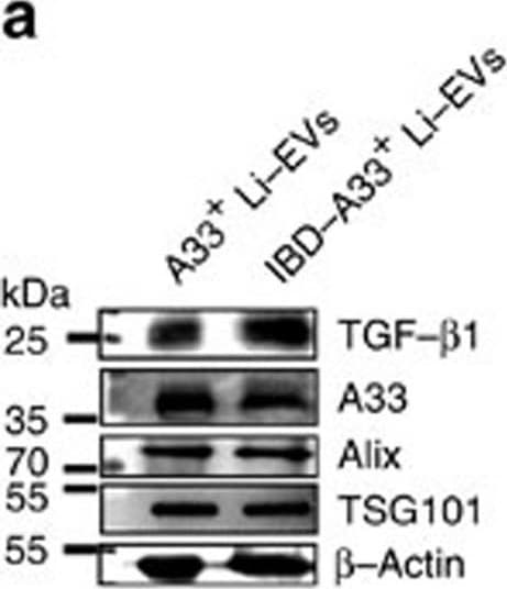 Detection of Mouse TGF-beta 1 by Western Blot