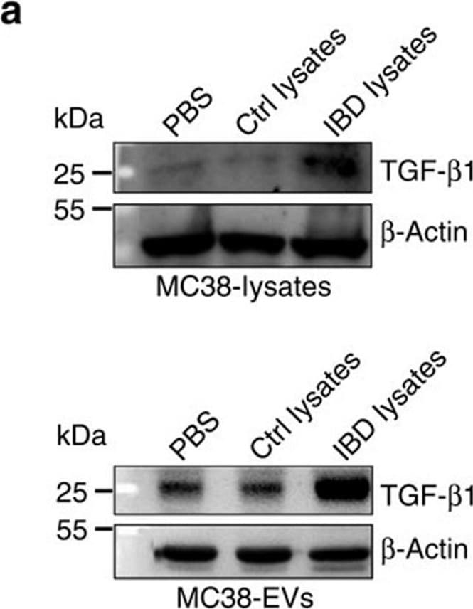 Detection of Mouse TGF-beta 1 by Western Blot