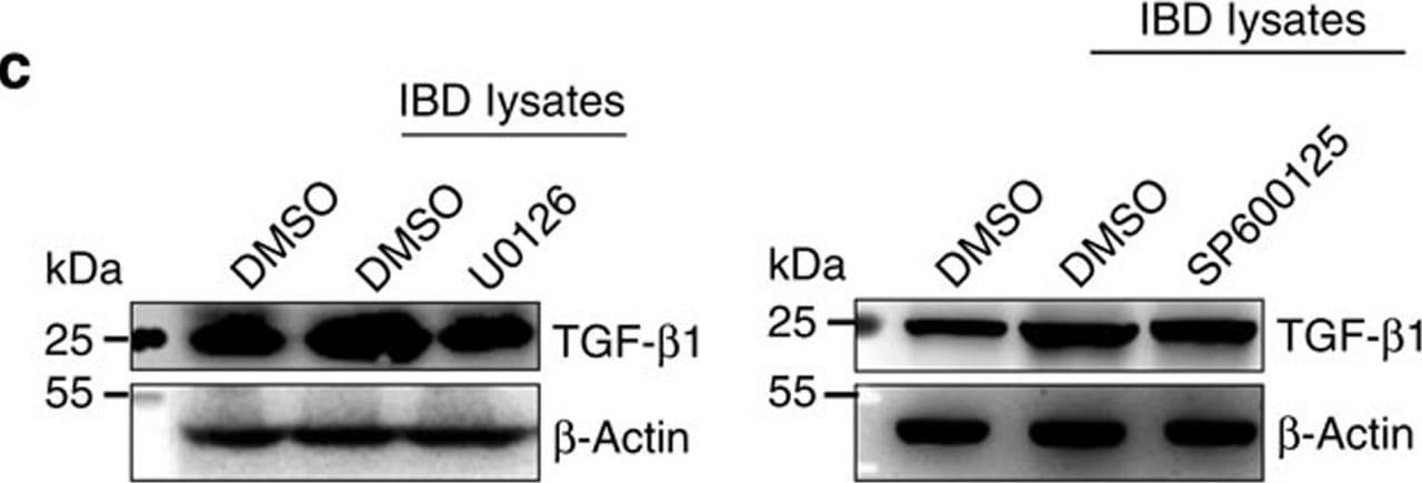Detection of Mouse TGF-beta 1 by Western Blot