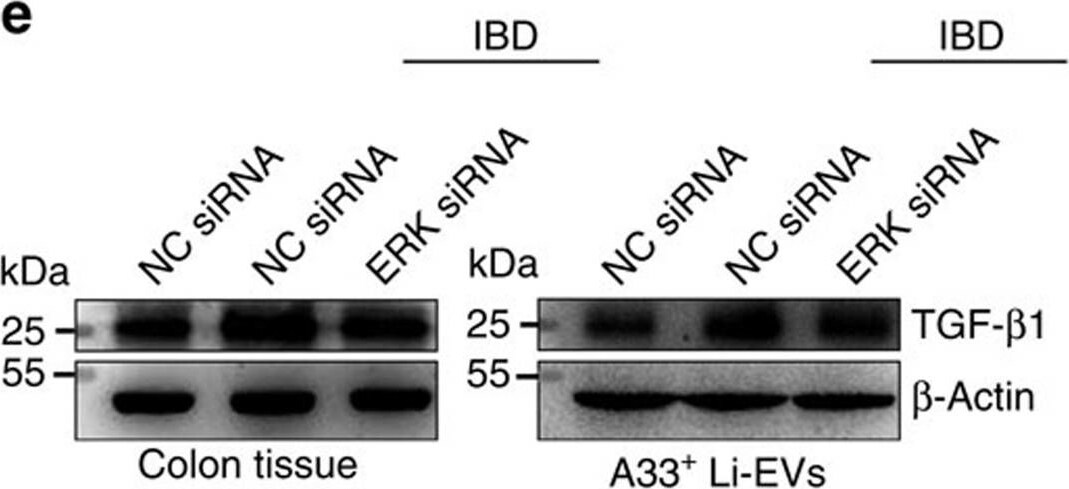 Detection of Mouse TGF-beta 1 by Western Blot