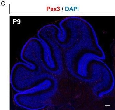 Detection of Pax3/Pax7/Pax7 by Immunohistochemistry
