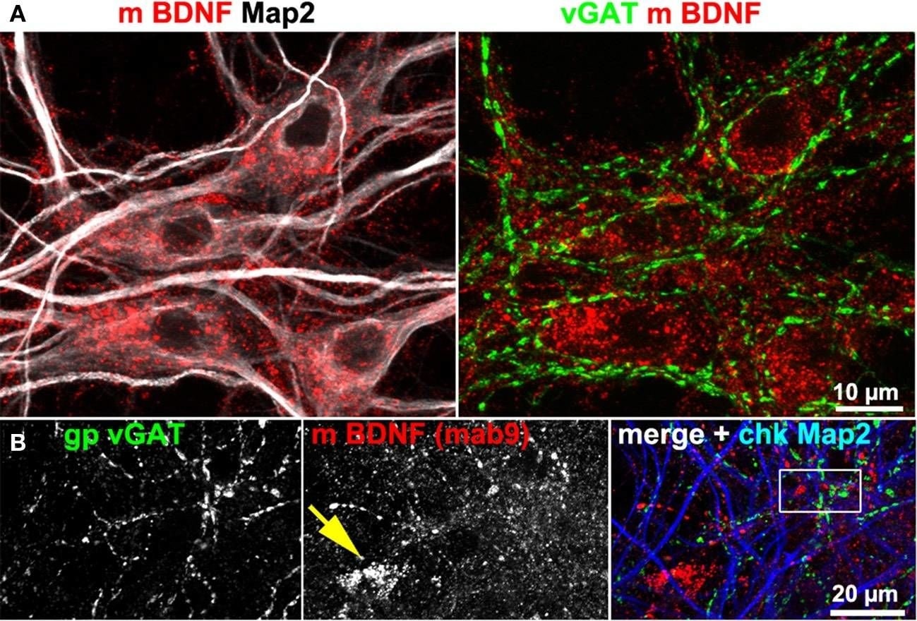 Detection of BDNF by Immunocytochemistry/ Immunofluorescence
