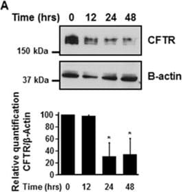 Detection of Human CFTR by Western Blot