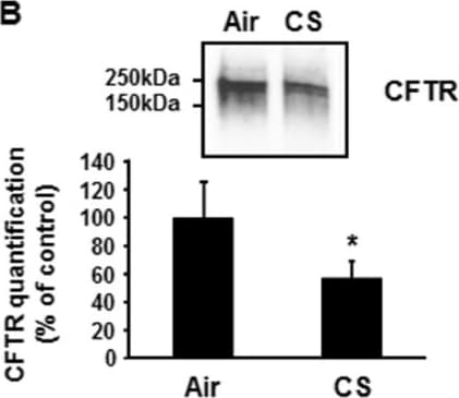 Detection of Human CFTR by Western Blot
