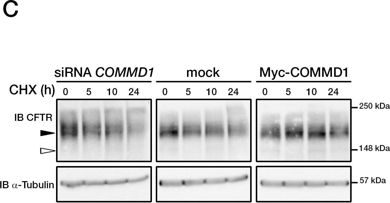 Detection of CFTR by Western Blot