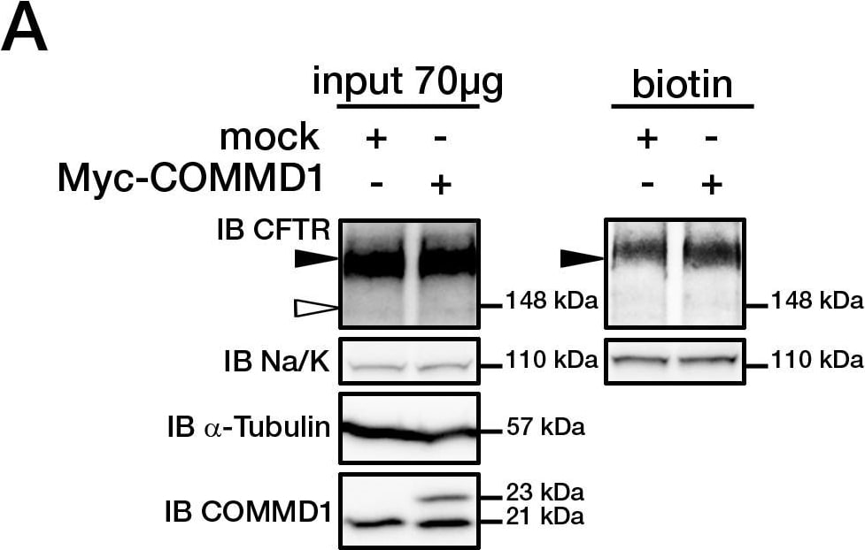 Detection of CFTR by Western Blot