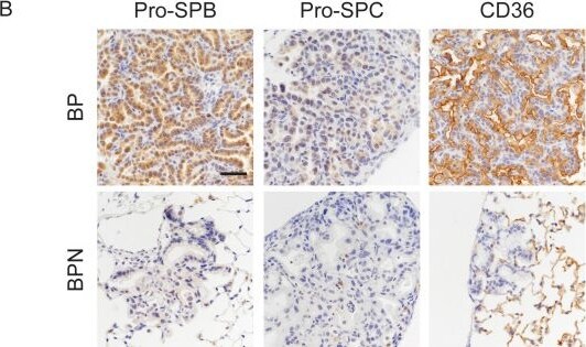 Detection of CD36/SR-B3 by Immunohistochemistry