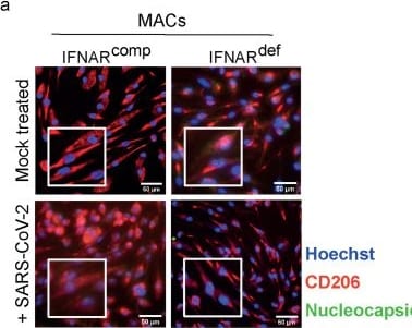 Detection of MMR/CD206 by Immunocytochemistry/ Immunofluorescence