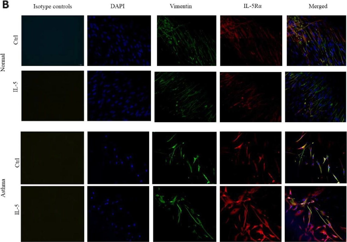 Detection of IL-5 R alpha by Immunocytochemistry/ Immunofluorescence