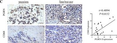 Detection of Progranulin by Immunohistochemistry