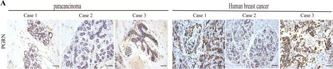 Detection of Progranulin by Immunohistochemistry