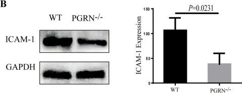 Detection of Progranulin by Western Blot