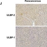 Detection of ULBP-1/MULT-1 by Immunohistochemistry