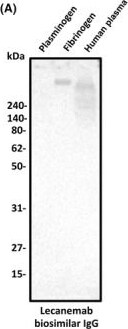 Detection of Plasminogen/Plasmin by Western Blot