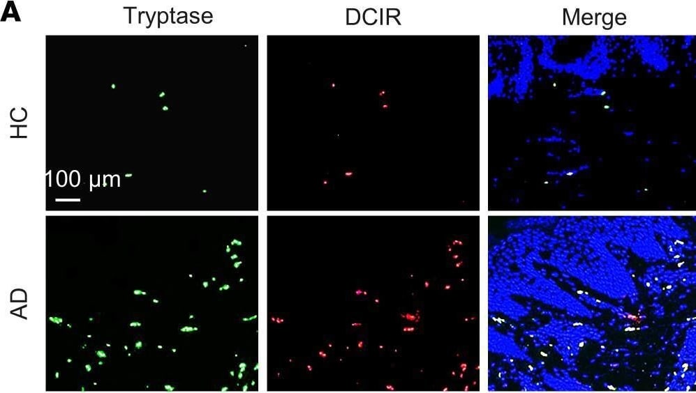 Detection of Mouse DCIR/CLEC4A by Immunohistochemistry