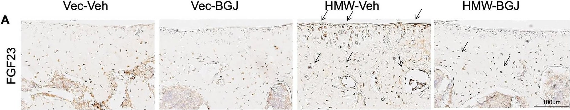 Detection of FGF-23 by Immunohistochemistry