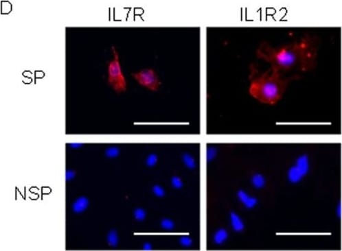 Detection of Human IL-1 RII by Immunocytochemistry/ Immunofluorescence